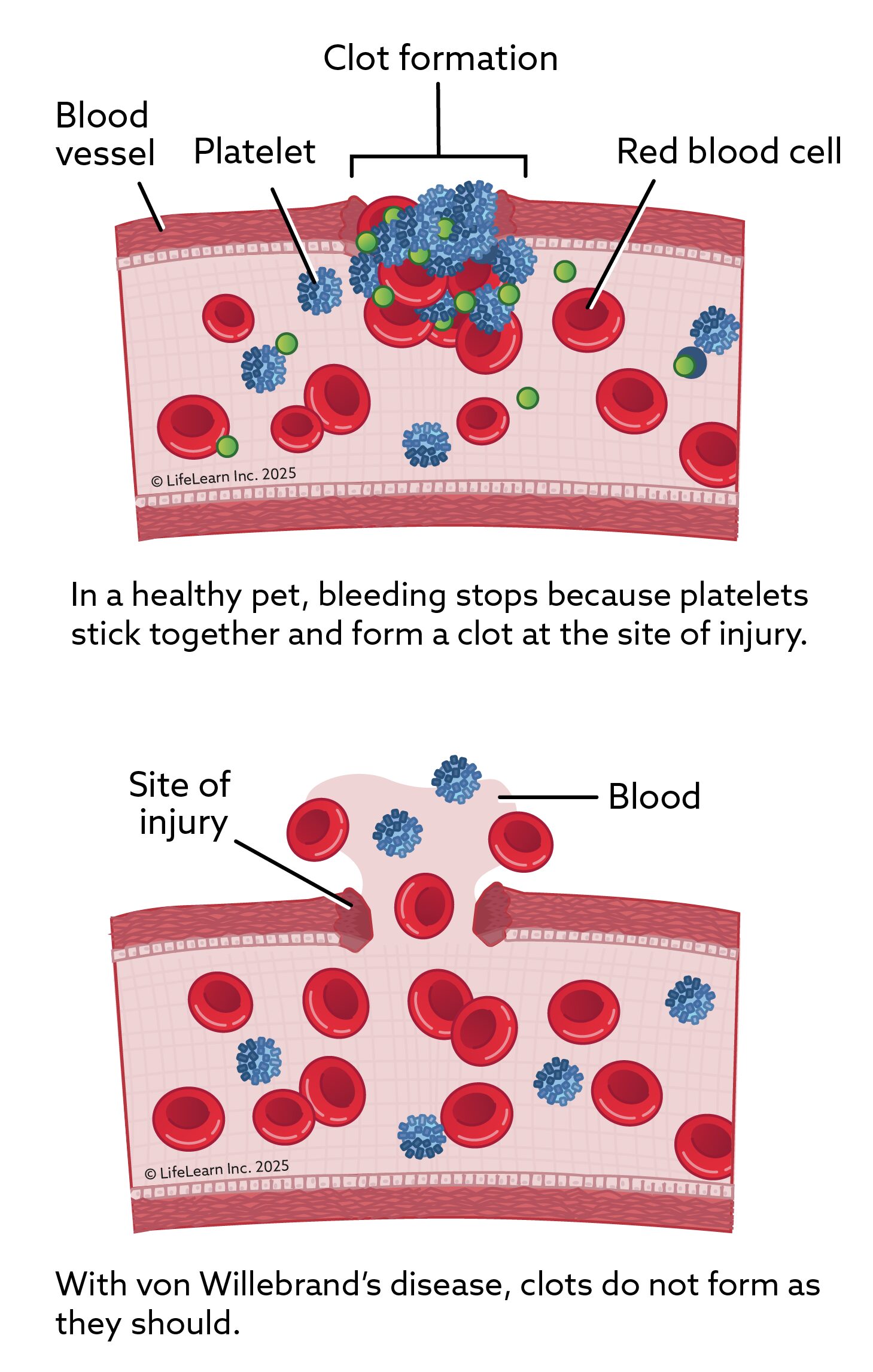 How von Willebrand Disease is inherited